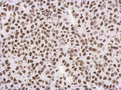 Histone H3 [Trimethyl Lys27] Antibody (NBP2-16840) by Novus